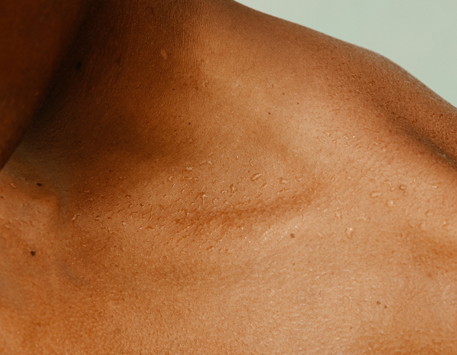 Les erreurs skincare qui aggravent l'hyperpigmentation