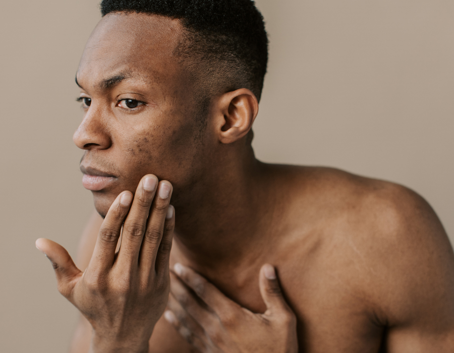 Qu'est-ce que l'hyperpigmentation et comment l'éviter ?